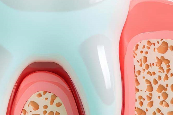 어금니 충치 통증 더 늦기 전에 시작해야 관련 이미지 29