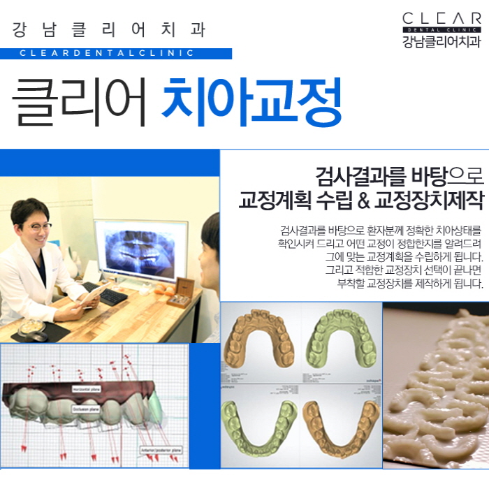 치아부분교정 앞니부분교정 정확한 진단이 중요 관련 이미지 5