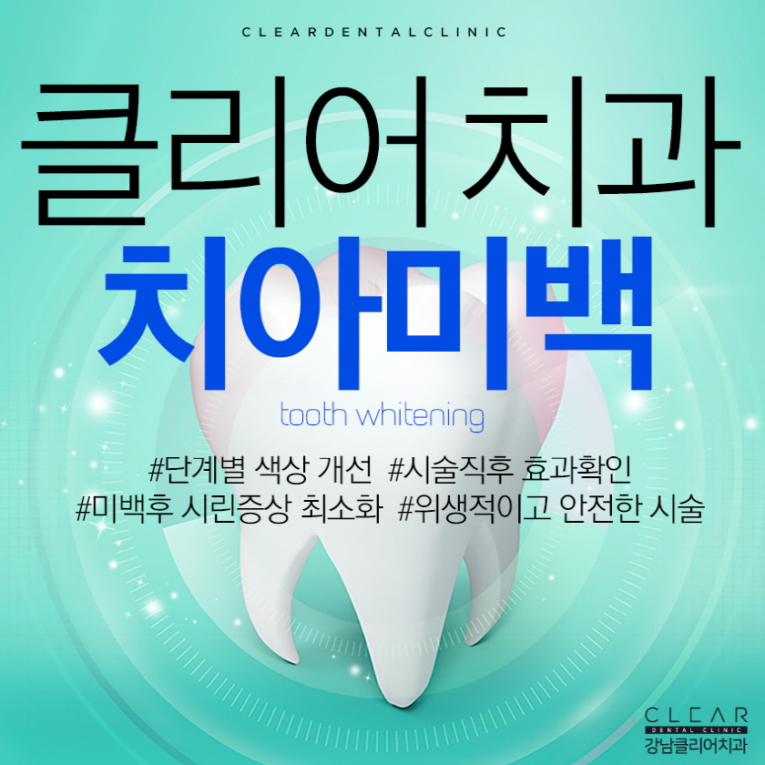 원데이 치아미백 금액 비용과 효과 알아보기 관련 이미지 1