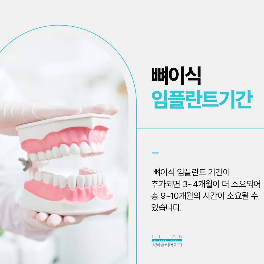 치과 뼈이식 임플란트 기간 과정 주의사항은? 관련 이미지 3