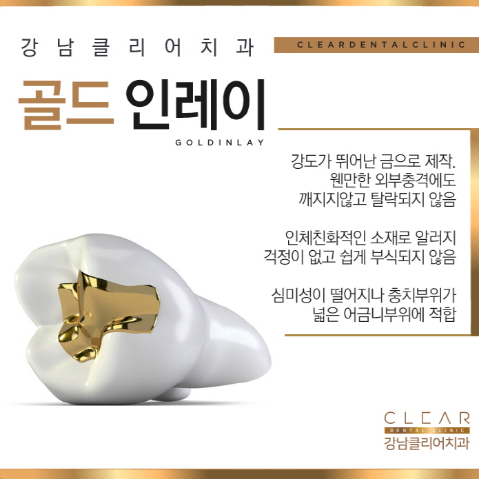 강남역충치 치료 개인별 맞춤형 최적의 솔루션 치료 관련 이미지 9