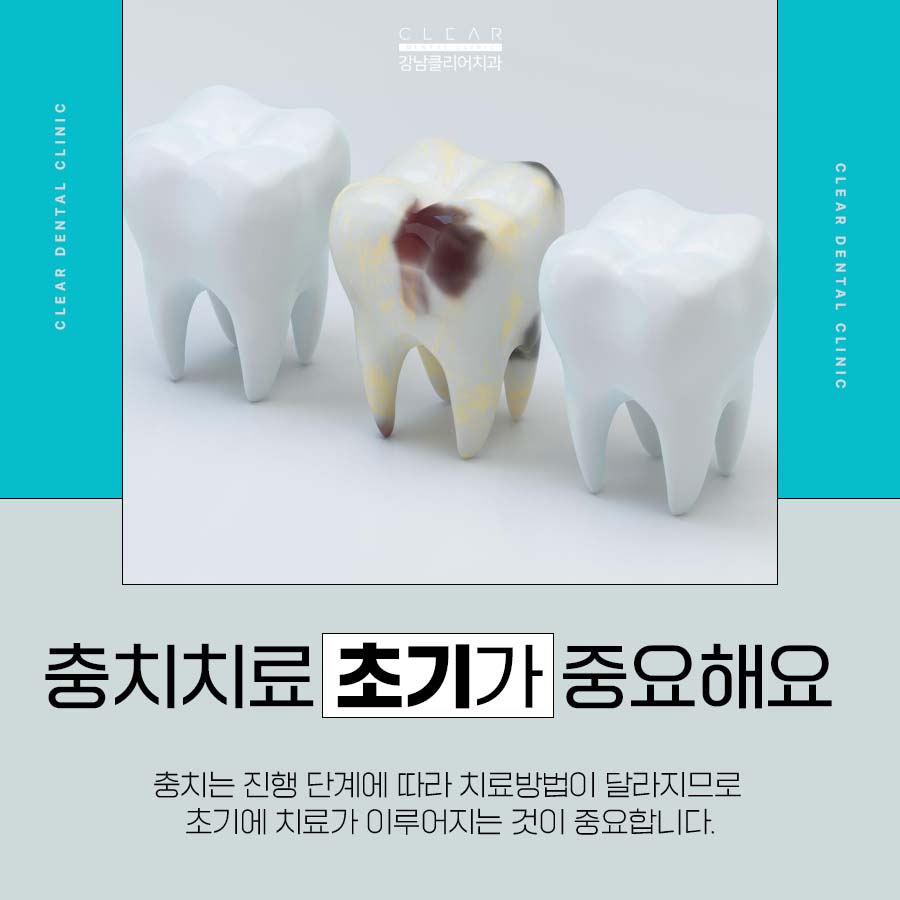 클리어치과 치아 까만점 원인 치료방법은? 관련 이미지 3