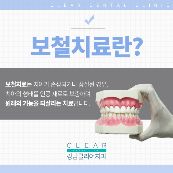 강남역치과 추천 치아 보철치료 관련 이미지 2
