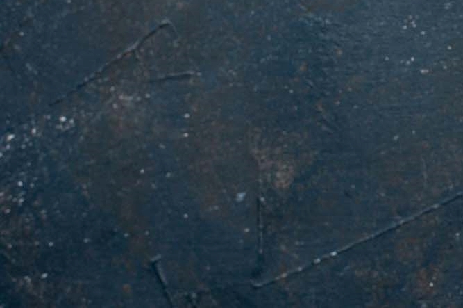 당뇨전단계 수치부터 관리 필요한 이유 초기증상은? 관련 이미지 12