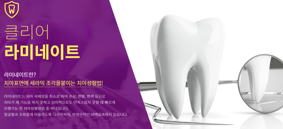 서울치과잘하는곳 찾는다면 투명교정도 함께 알아봐요 관련 이미지 10