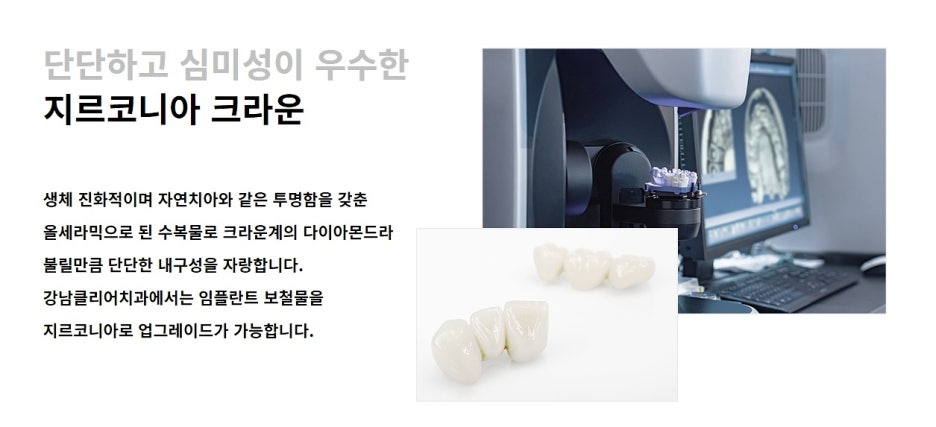 강남역 임플란트 잘하는곳 판단하고 결정해야 관련 이미지 8