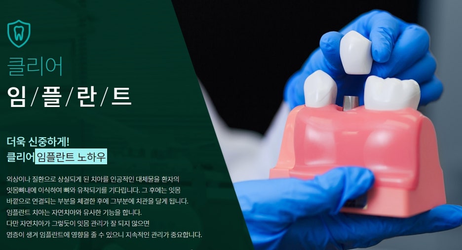 강남역 임플란트 잘 알아봐야 해 관련 이미지 2