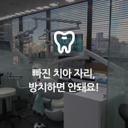 임플란트 - 빠진 치아 자리, 방치하면 안 돼요! 관련 이미지 8