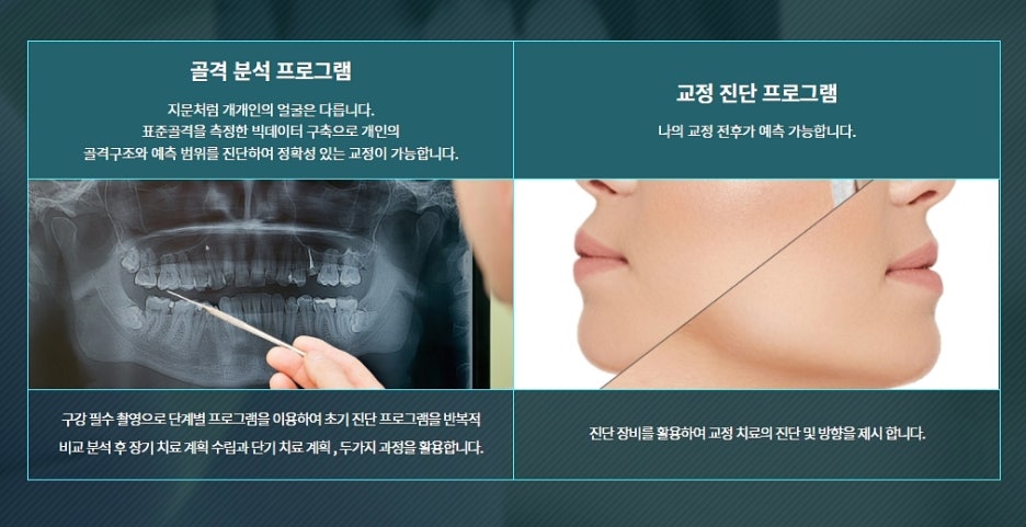 2호선 클리피씨 여기를 주목 관련 이미지 4