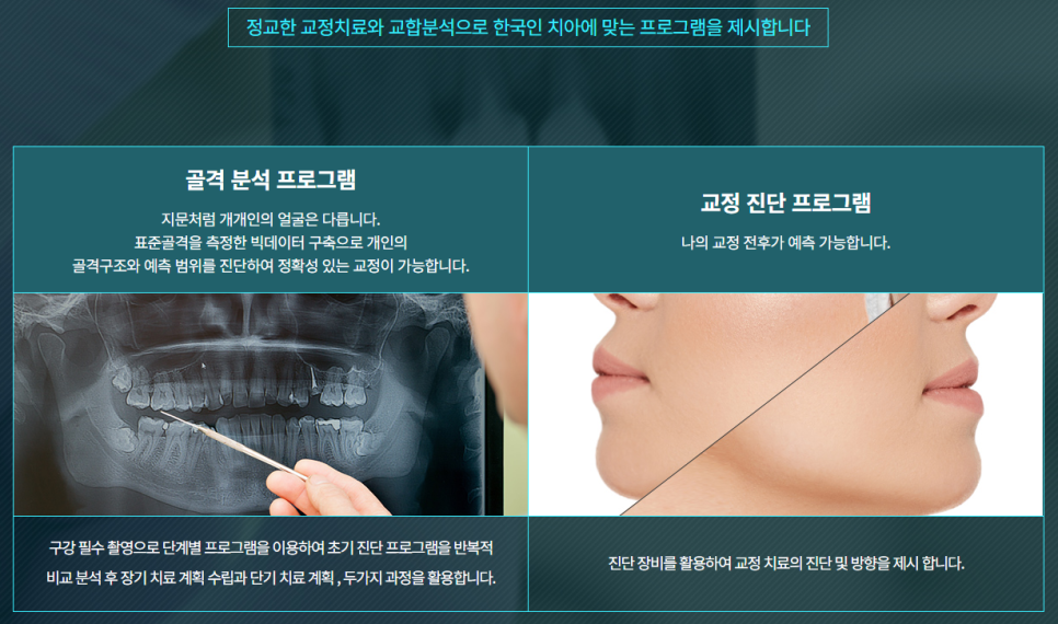 논현동치아교정 심미적인 부분을 놓치기 싫다면? 관련 이미지 6
