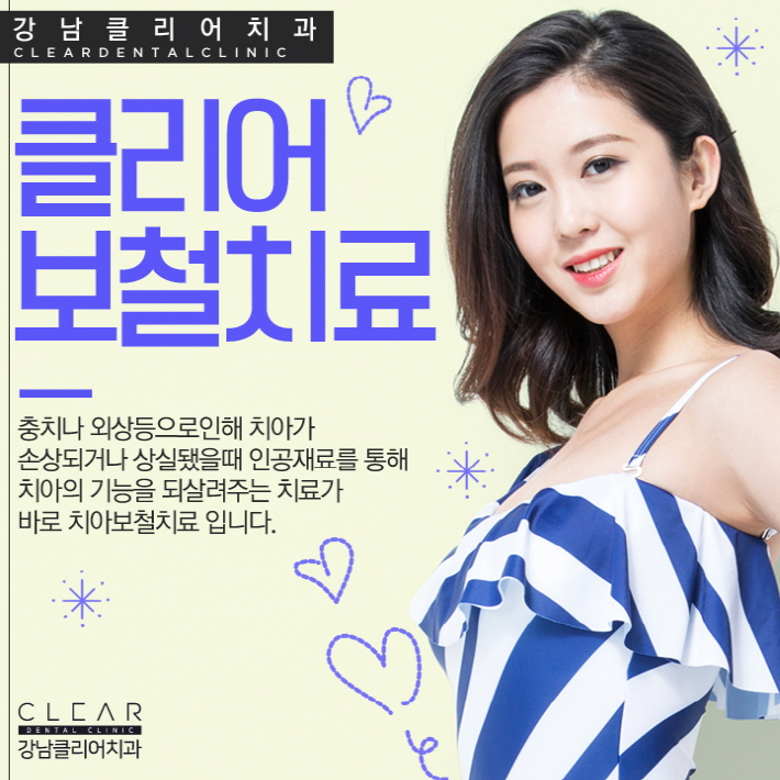 치아 보철치료 종류 심미보철 등 다양해 관련 이미지 1