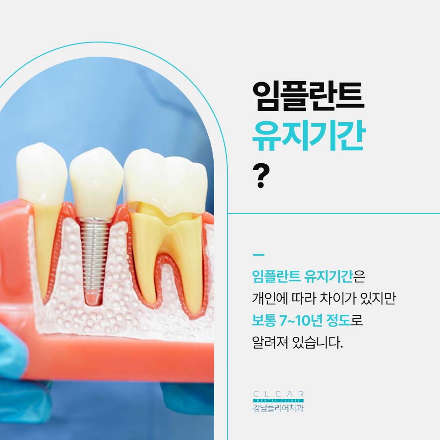 역삼동 임플란트 치과 유지기간 오래 쓰려면 주의사항 관련 이미지 3