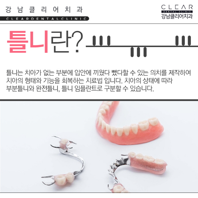 틀니 부분틀니 전체틀니 임플란트틀니 보험틀니까지 관련 이미지 2