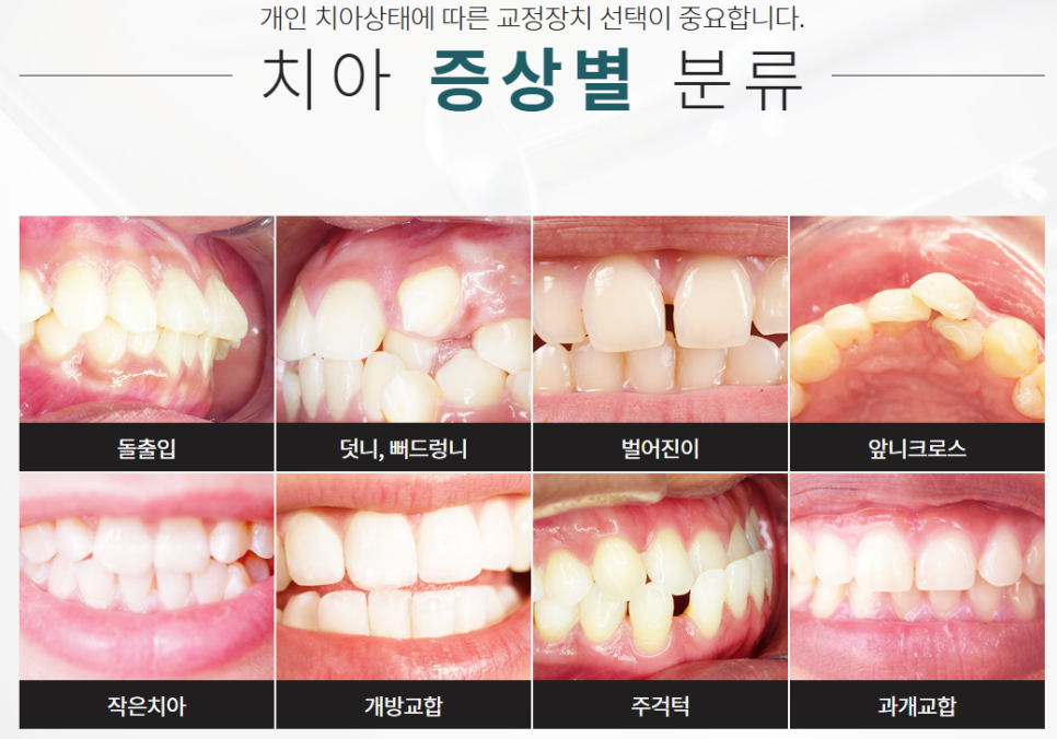 클리어치과 임플란트 교정부터 미백케어까지 관련 이미지 7