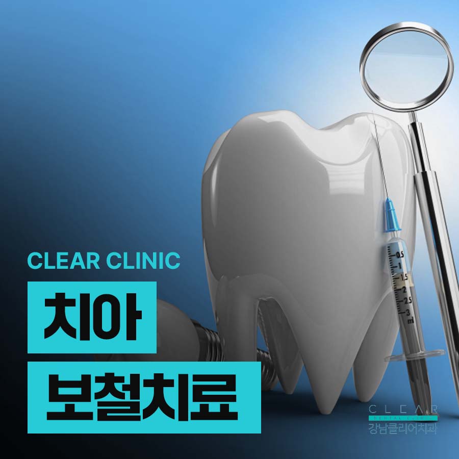 치아보철치료 크라운 치료가 필요한 경우는 관련 이미지 1