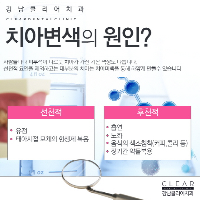 원데이치아미백 치과 치아미백 이벤트로 착한가격까지 관련 이미지 2