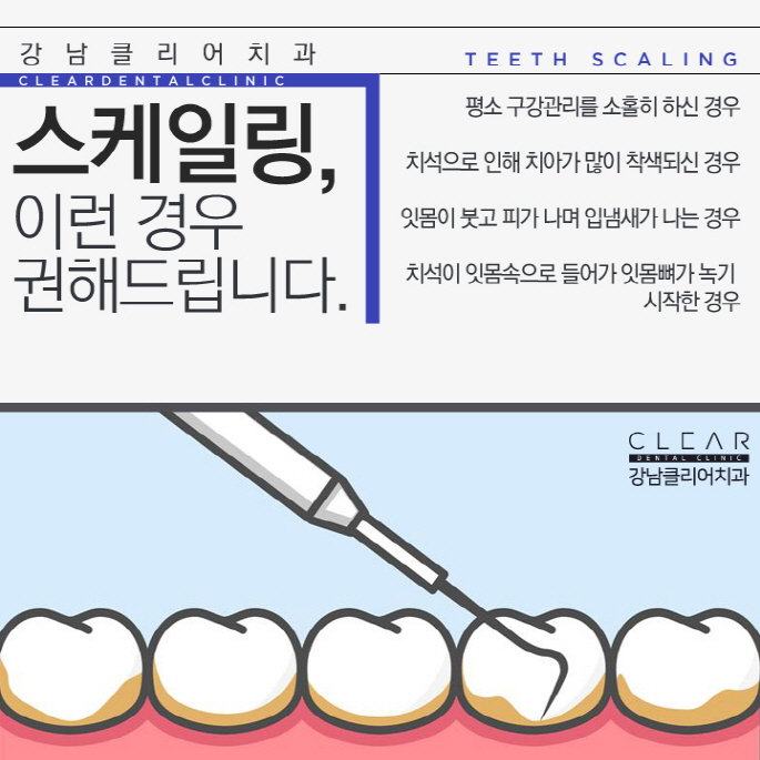 굿스케일링 강남클리어치과 치과 스케일링 보험과 비용 관련 이미지 3