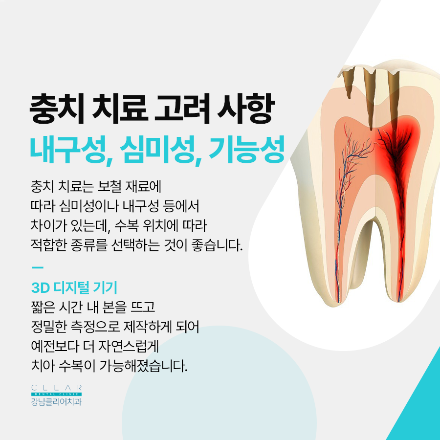 강남 레진치료 여름철 충치 사례 증가 주의가 필요합니다 관련 이미지 4