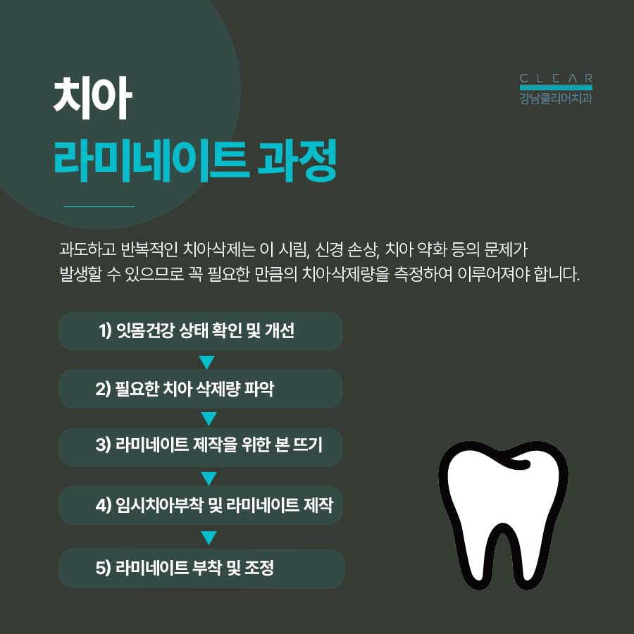 라미네이트 치아삭제 꼭 필요한 만큼만 해요 관련 이미지 4