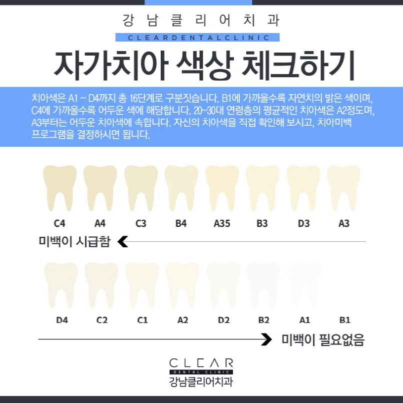 원데이 치아미백 금액 비용과 효과 알아보기 관련 이미지 4