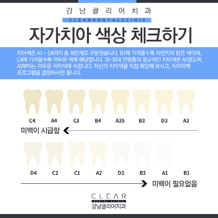 치과치아미백 미백단계 톤 조절 가능 관련 이미지 2