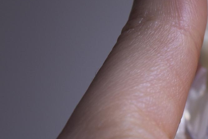 당일 임플란트 조건 무엇이 필요할까 관련 이미지 19