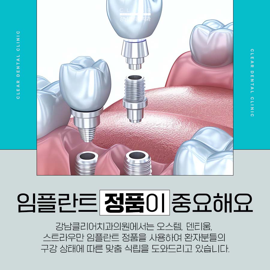 스트라우만 임플란트 특징 정품을 사용해야 되는 이유 관련 이미지 4