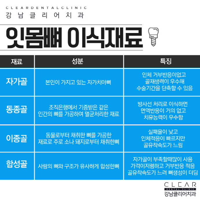 뼈이식임플란트 무엇이며 뼈이식은 왜 중요할까? 관련 이미지 3