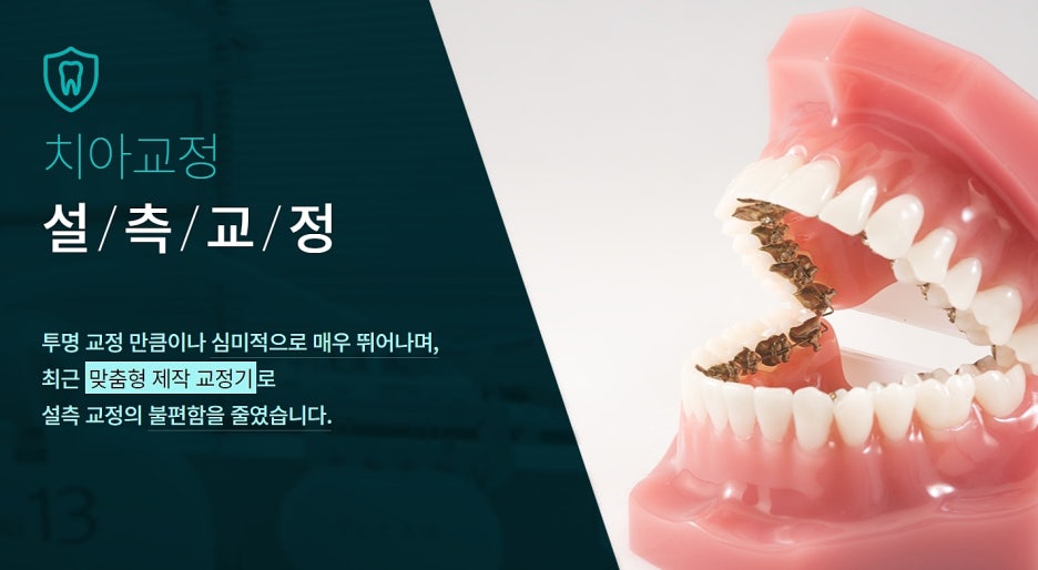 강남 설측교정 할 의향이라면? 관련 이미지 3