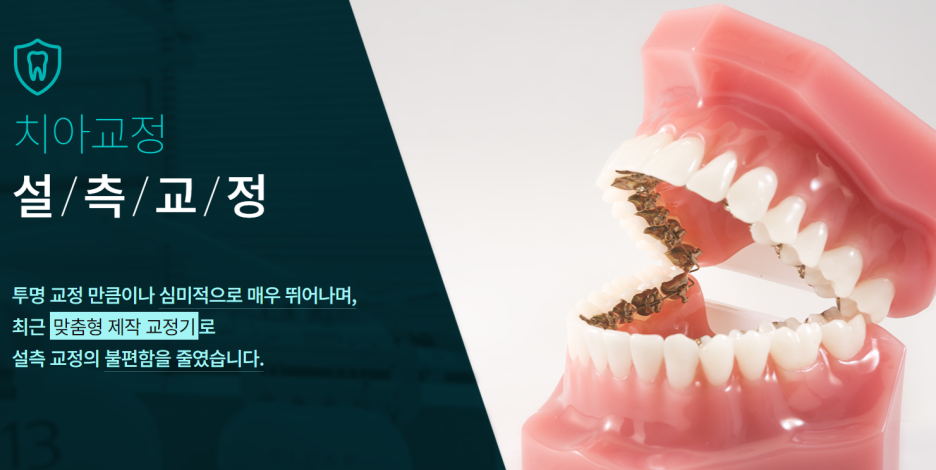 서초동교정치과 기능과 심미성 모두 놓치지 않도록 관련 이미지 4