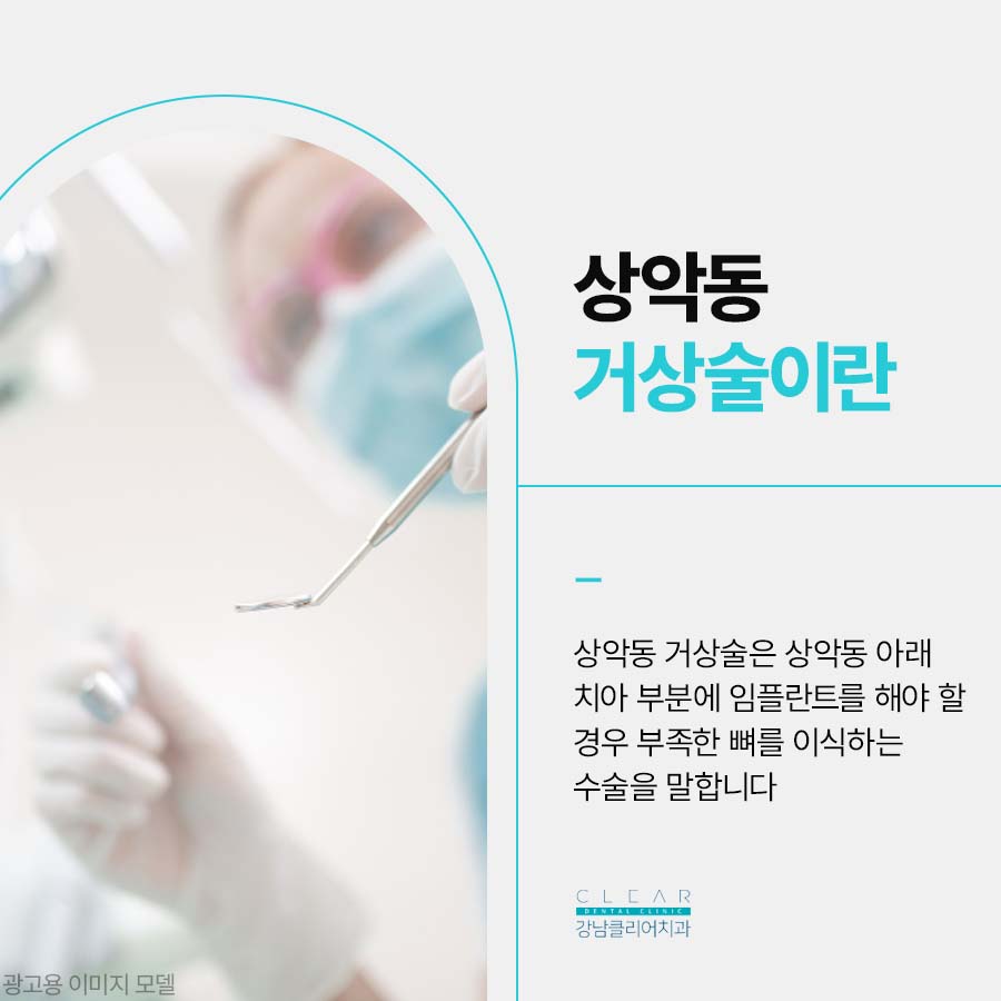상악동 거상술 붓기 부담을 줄이려면 관련 이미지 2