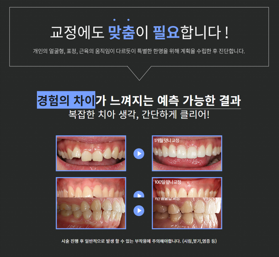 강남역 교정치과 치열을 예쁘고 고르게! 관련 이미지 2