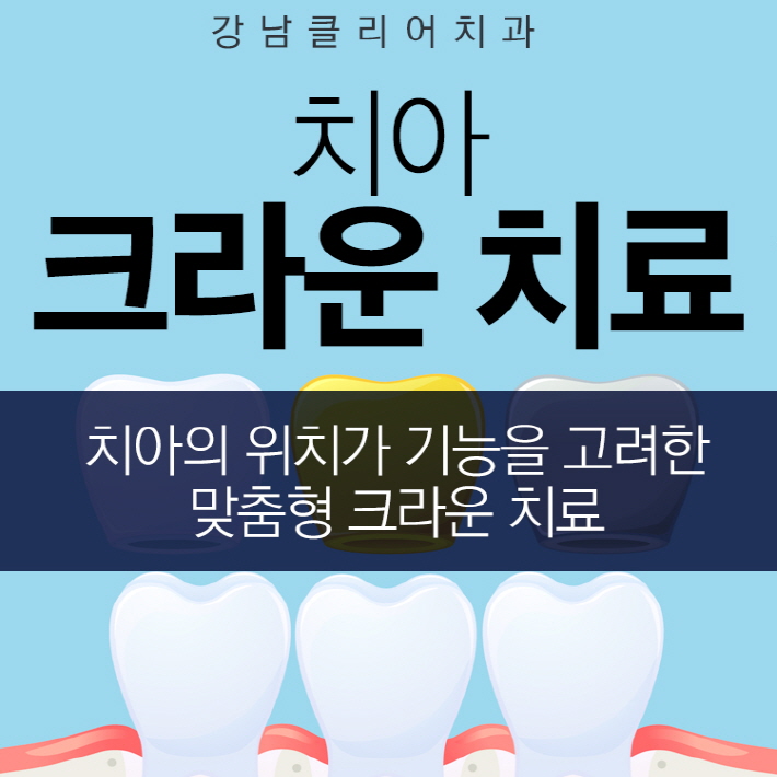 치아 크라운 치료 어떤 종류가 있고 언제 필요한가? 관련 이미지 1