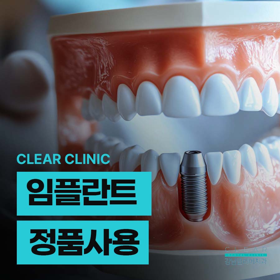 임플란트 정품사용 알아보는 방법 관련 이미지 1