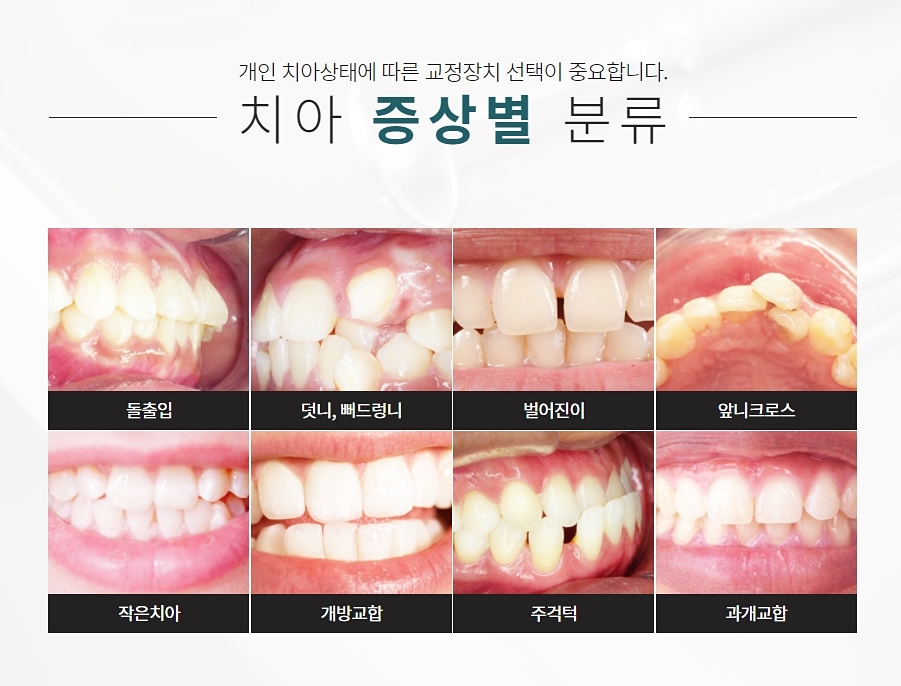 2호선 클리피씨 여기를 주목 관련 이미지 6