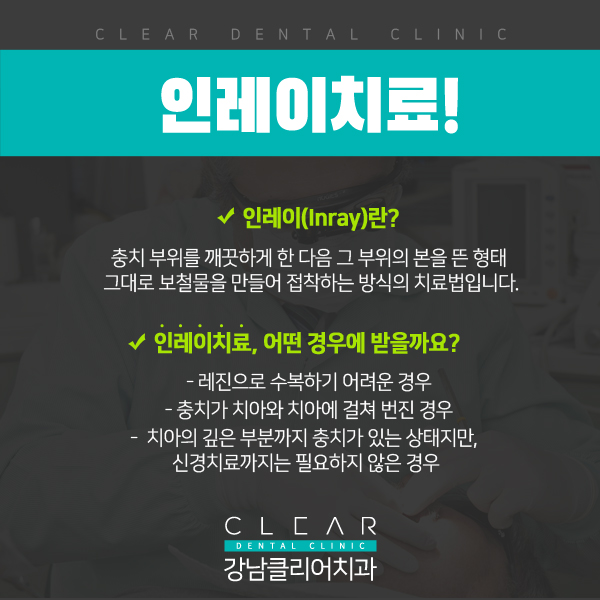 강남충치치료 레진,인레이 단계별 치료방법 관련 이미지 6