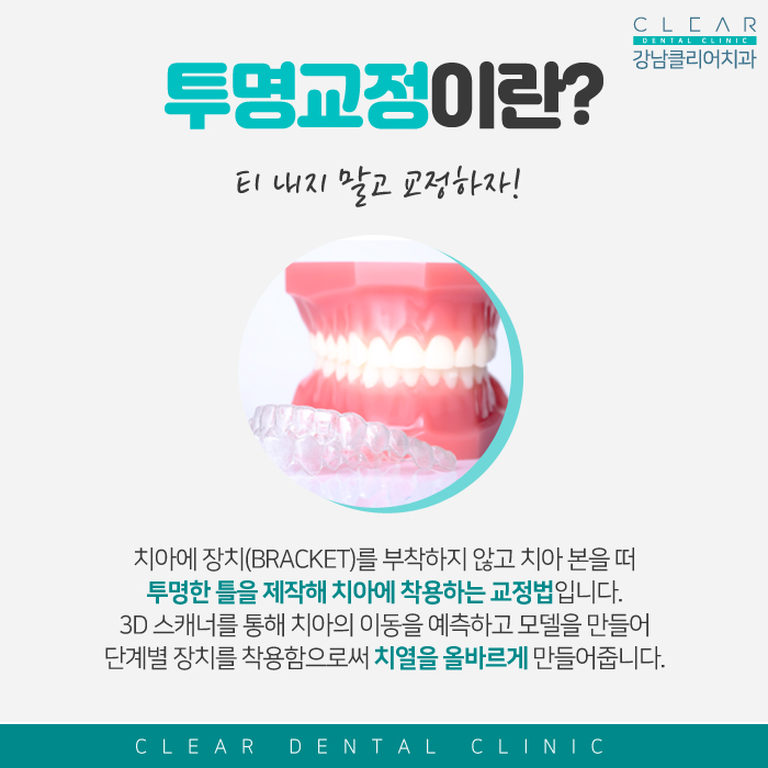 강남투명교정 티 내지 말고 교정하자! 관련 이미지 2