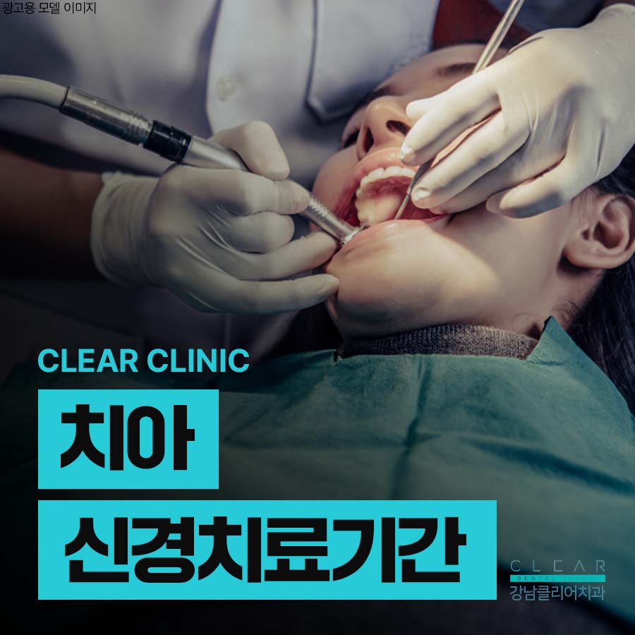치아 신경치료 기간 하루에 안 되는 이유 관련 이미지 1