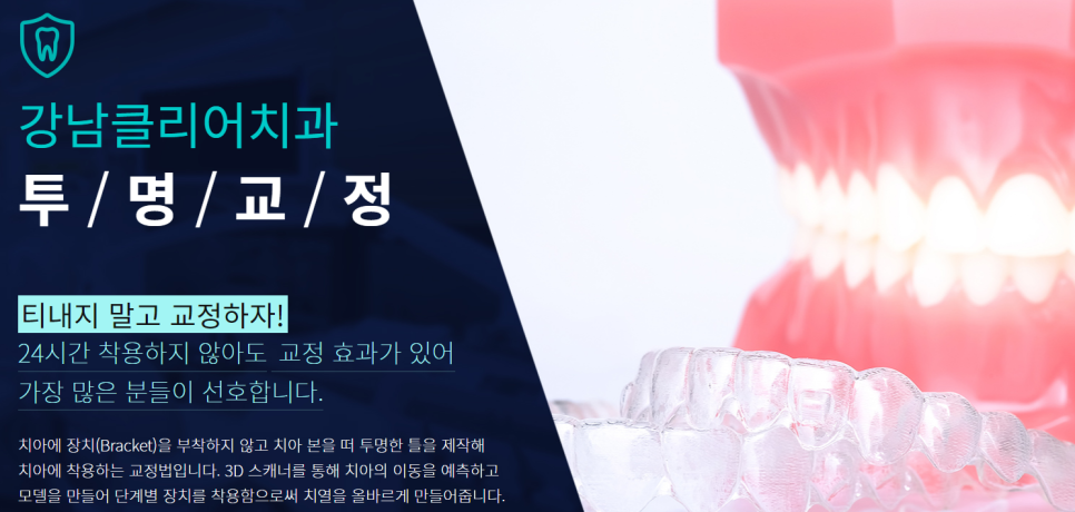 강남치아교정 배열이 신경쓰이는 경우라면? 관련 이미지 2