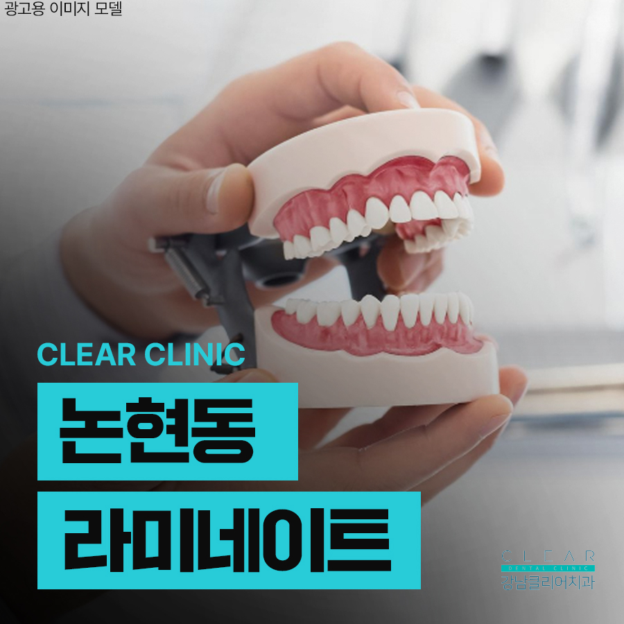 논현동 라미네이트 주의사항 꼭 알아야해요 관련 이미지 1
