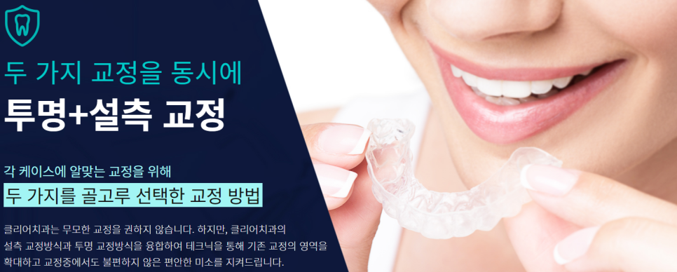 강남치아교정 기간 단축으로 불편함 적게 관련 이미지 5