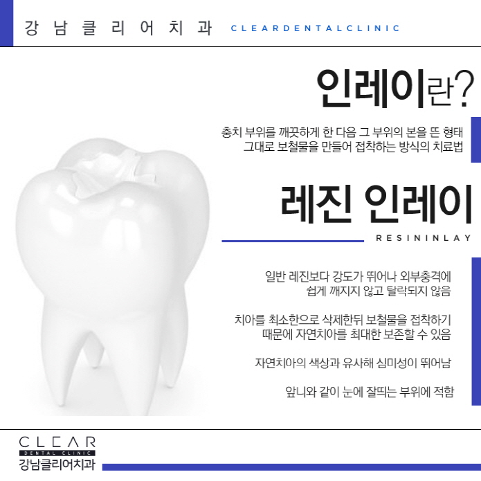 강남역충치 치료 개인별 맞춤형 최적의 솔루션 치료 관련 이미지 8