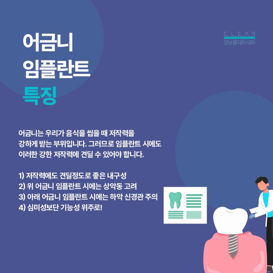강남역 임플란트치과 앞니 어금니 부위에 따라 달라 관련 이미지 3