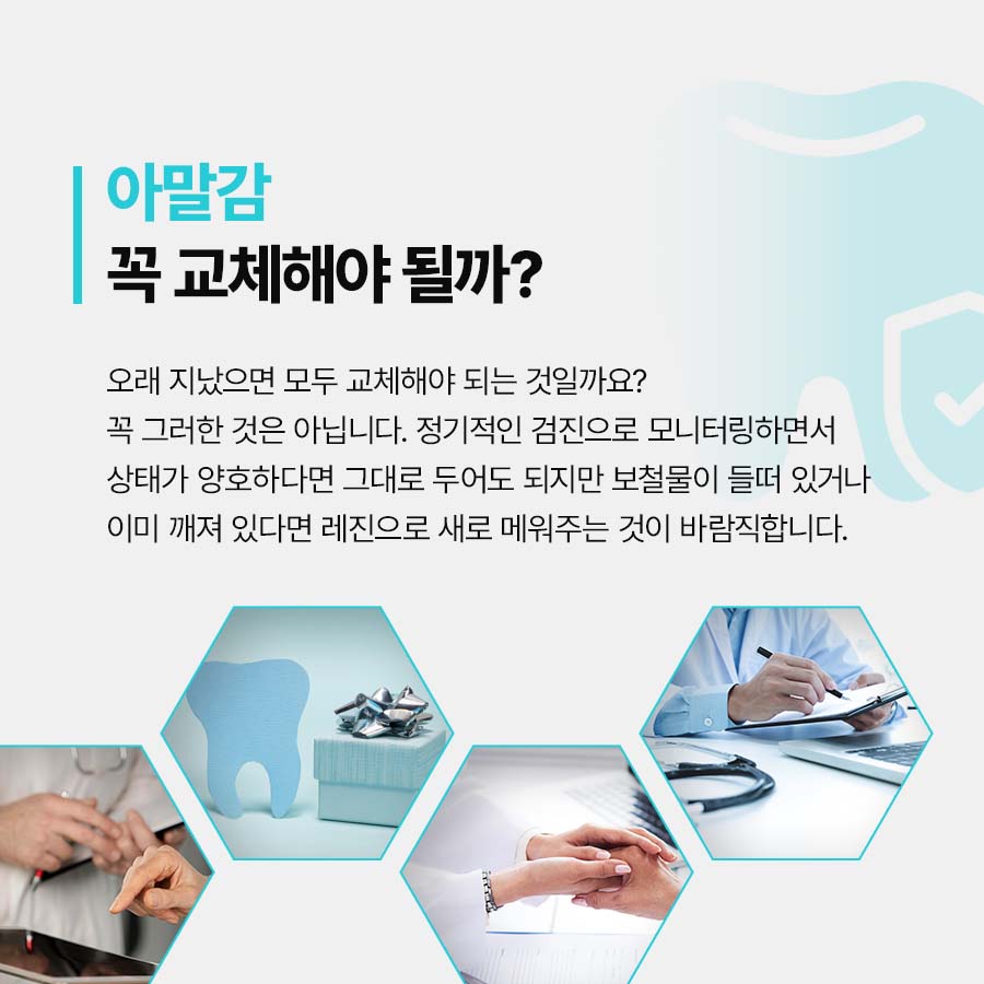 아말감 깨짐 떨어짐 대처방법 어떻게? 관련 이미지 4