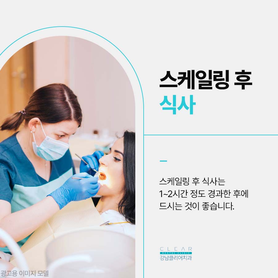 스케일링 후 식사 언제부터? 권장주기는? 관련 이미지 5