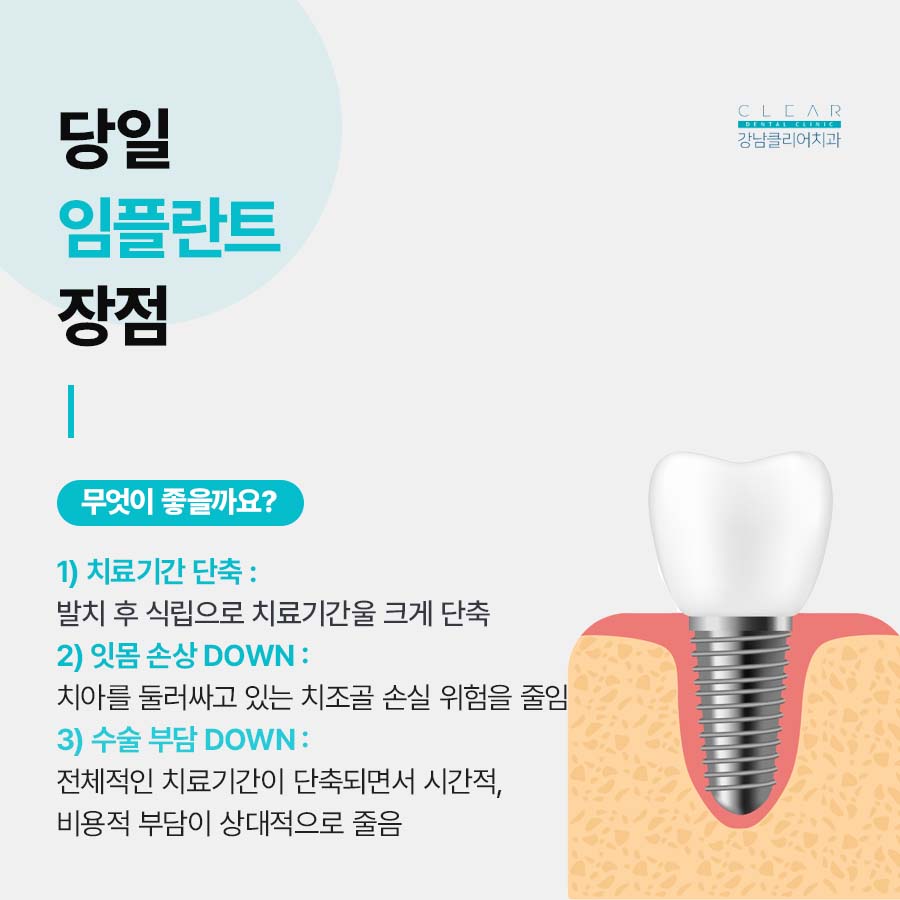 역삼 당일 임플란트 이러한 분들에게 좋아요 관련 이미지 4