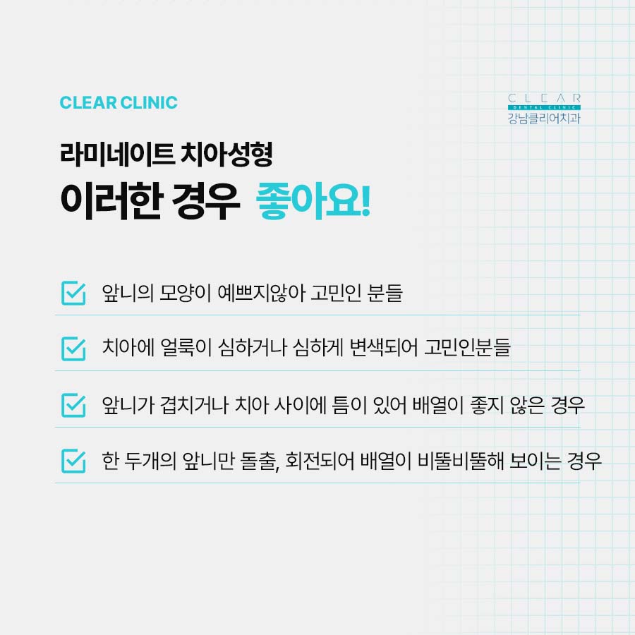 클리어치과에서 클리어한 라미네이트를 관련 이미지 2