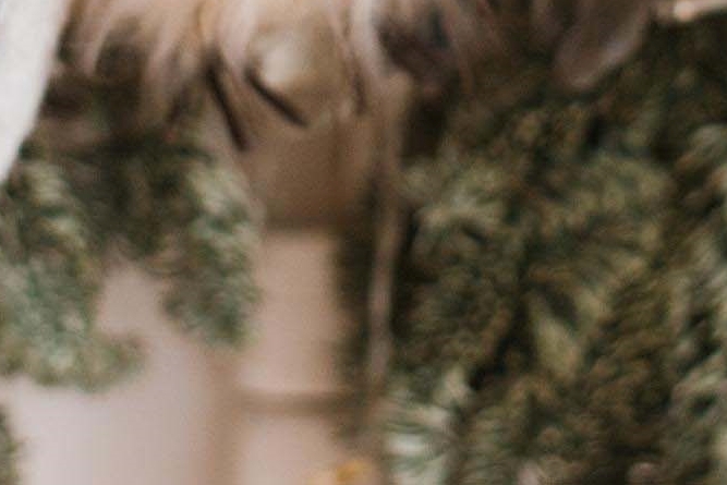 라미네이트 치아삭제 꼭 필요한 만큼만 해요 관련 이미지 31