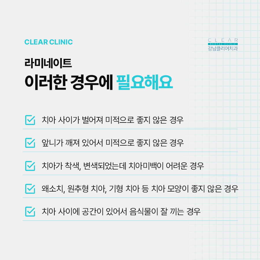 논현동 라미네이트 주의사항 꼭 알아야해요 관련 이미지 3