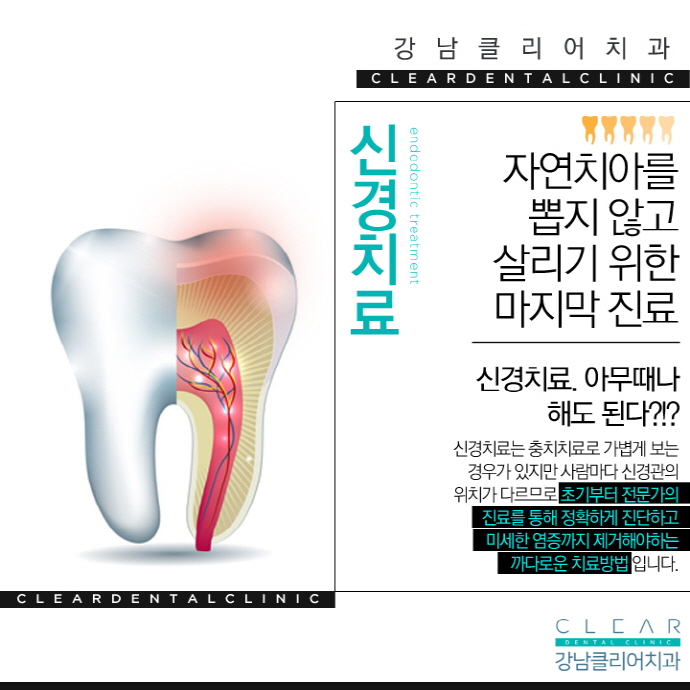 강남역충치치료 간단한 치료가 아니에요 관련 이미지 7